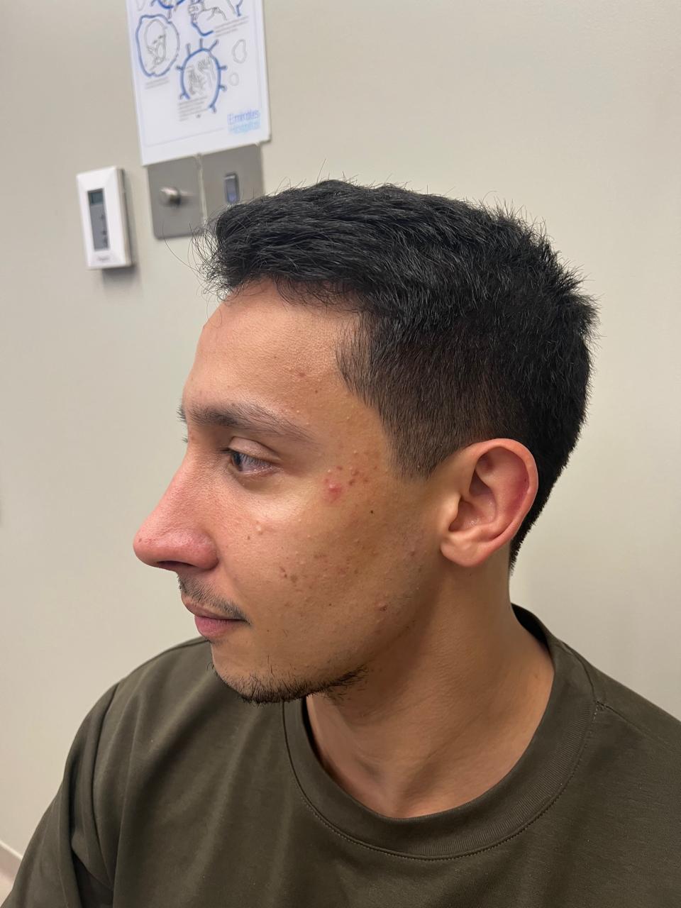 Patient reviews and experiences highlighting ENT consultations, functional and aesthetic rhinoplasty, and personalised care by Dr. Abdul Razzak Juratli in Dubai and Sharjah.